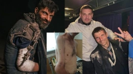 Szokujące zdjęcie obrońcy Mariupola z rosyjskiej niewoli wstrząsnęło opinią publiczną. Ukraińcy zbierają na leczenie żołnierza