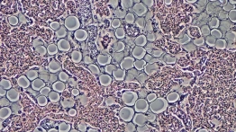 Jak terapia komórkami macierzystymi rewolucjonizuje medycynę [Materiał promocyjny]