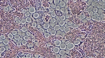 Jak terapia komórkami macierzystymi rewolucjonizuje medycynę [Materiał promocyjny]