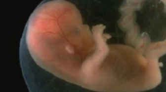 NoAbortionTourism.eu: nowa kampania przeciw finansowaniu „turystyki aborcyjnej” w UE