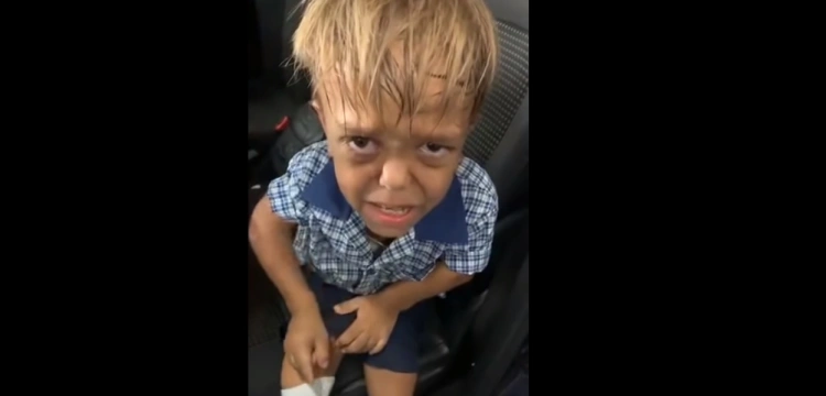Dramatyczne nagranie 9-latka cierpiącego na karłowatość