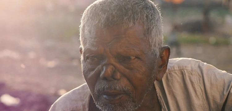 Trąd dotyka dziś miliony osób. Pomoc niosą im chrześcijanie 