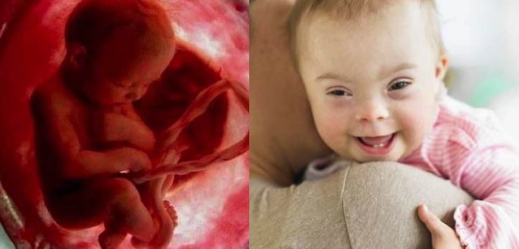 Jarosław Kaczyński i PiS na pewno zakaże aborcji eugenicznej