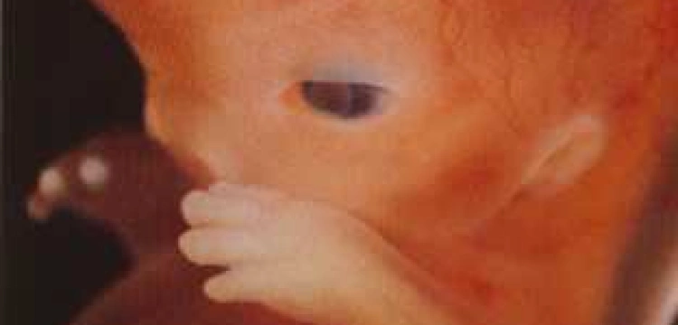 Potrzebni są biskupi obrońcy życia