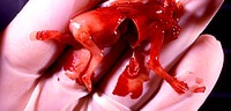 Promocja aborcji dla Polek na Wyspach doprowadzi do jej zakazu?