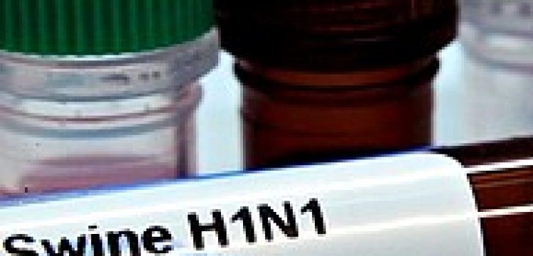 Świńska grypa. Pandemia, czy gigantyczne oszustwo?