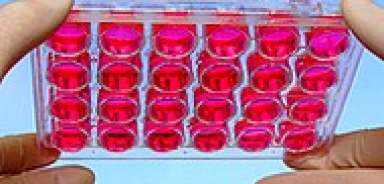 In vitro zwiększa zagrożenie urodzenia martwego dziecka