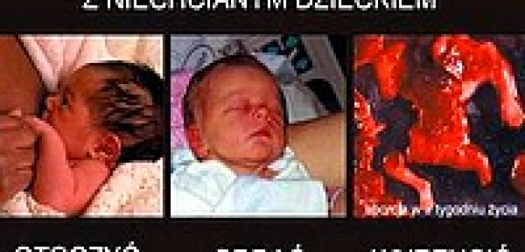 Antyaborcyjna wystawa „Wybierz życie” nie podoba się... UKSW