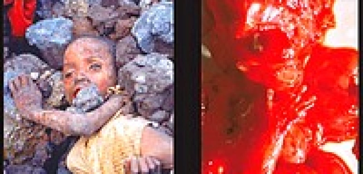 Rzeź na placu Chrobrego czy w gabinetach aborcyjnych? Dzierżawski odpowiada „Wyborczej”