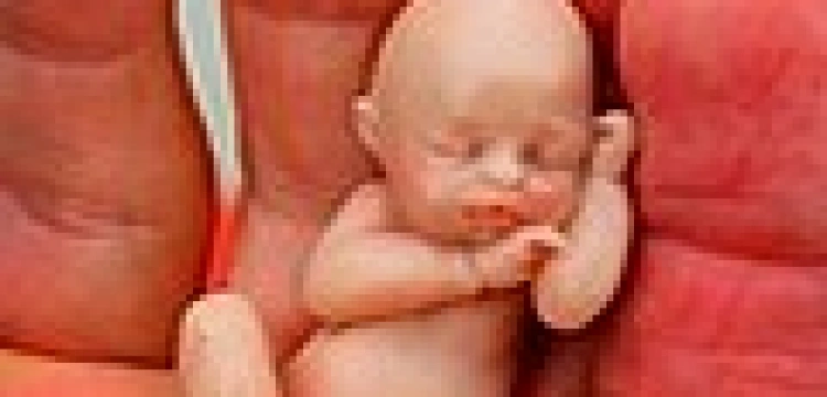 Grupa europosłów chce zablokować finansowanie aborcji przez UE