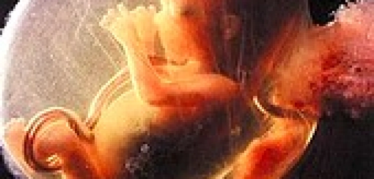 W 2008 roku w Polsce przeprowadzono rekordową liczbę legalnych aborcji