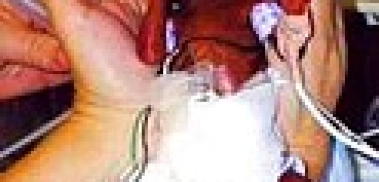 W Wielkiej Brytanii lekarze nie uratowali wcześniaka, bo bali się przepisów