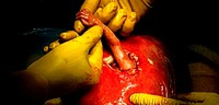 W Białymstoku pochowano nienarodzone dzieci