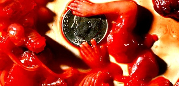 Krwawe pieniądze. O co walczy biznes aborcyjny?