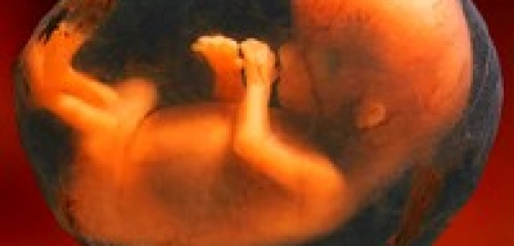 Zabicie cudzego dziecka jak złamanie ręki