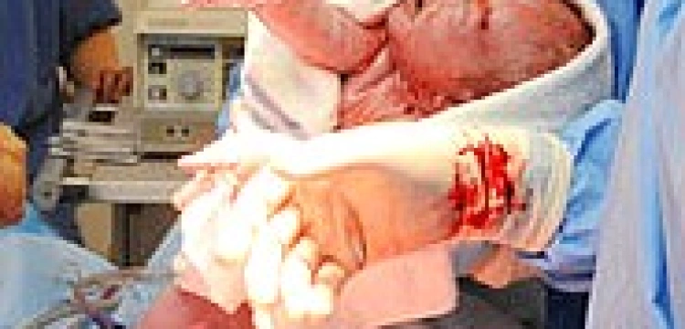 WHO: "Cesarki" są niebezpieczne