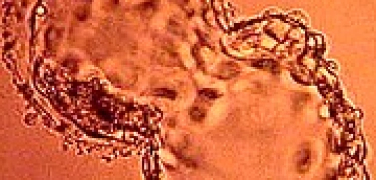 Prawo nie chroni ludzkiego embrionu, bo nie jest on „nienarodzony”