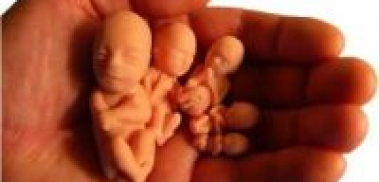 Inicjatywa pro life w diecezji gliwickiej