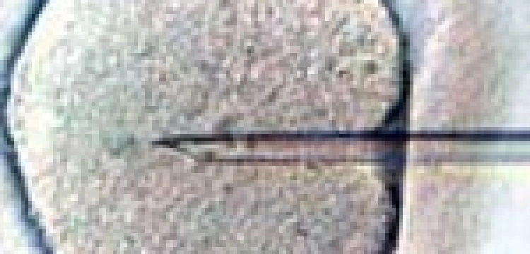 Dziecko na zamówienie