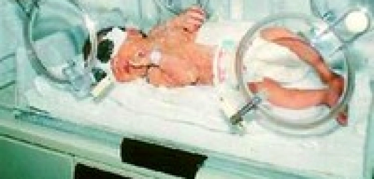 Francuski sąd zakazał "nadmiernego" ratowania życia