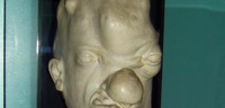 "Choroba francuska" sieje postrach w Niemczech