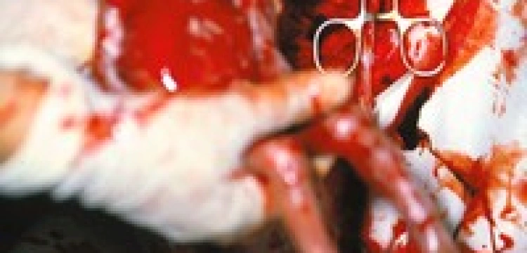 "Usunąć dziecko, to jak wyciąć nowotwór" 