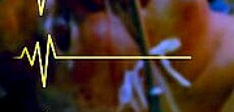 Coraz więcej eutanazji w Holandii