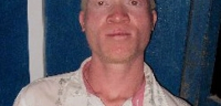 Chciał sprzedać kolegę-albinosa