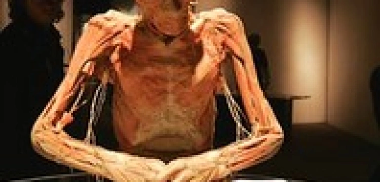 Śledztwo w sprawie wystawy ciał znów zawieszone