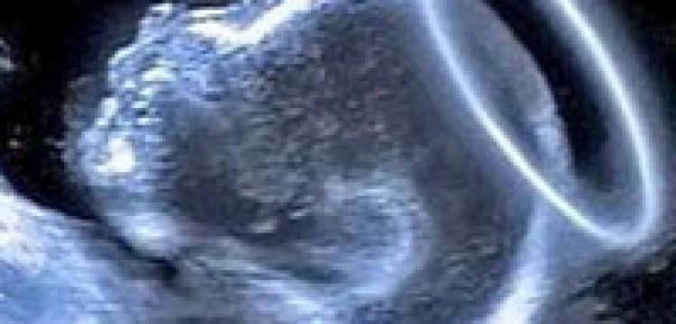 Plakat z wizerunkiem nienarodzonego Jezusa zniechęci do aborcji?  