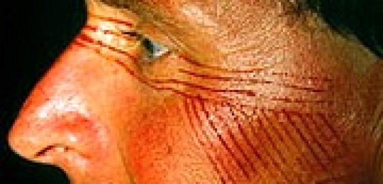 Cejrowski też wyczyszczony