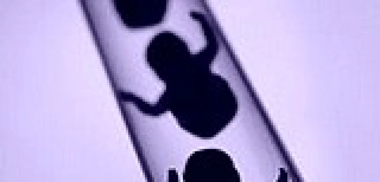 „Wybór jest prosty: albo cywilizacja życia, albo szambo”