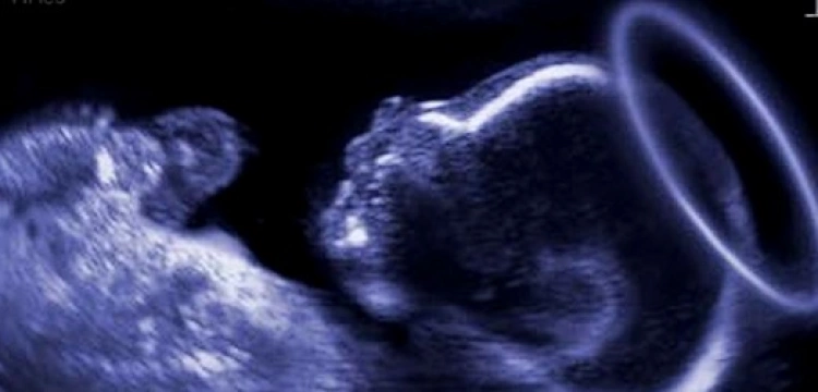 Uratuj  świętego w Wielkim Poście