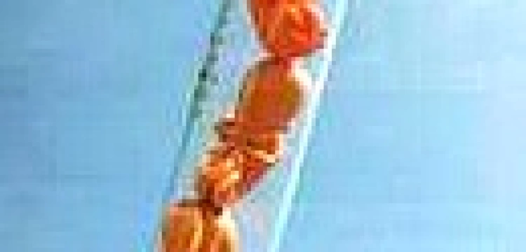 Kolejny projekt w sprawie in vitro trafi do Sejmu