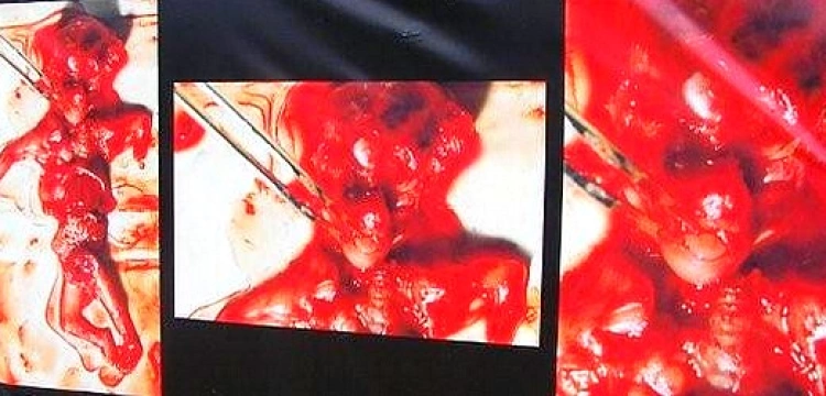 Burmistrz Żywca nie chce, by mieszkańcy "wybrali życie"