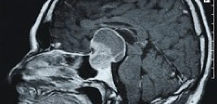 Chorzy w stanie wegetatywnym będa mogli kontaktować się ze światem