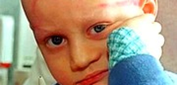 Belgia pozbędzie się chorych maluchów?