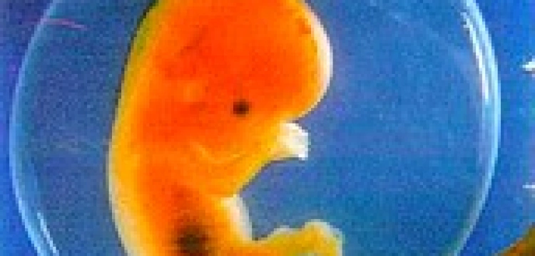 Irlandia: Silne poparcie dla prawnej ochrony ludzkich embrionów 