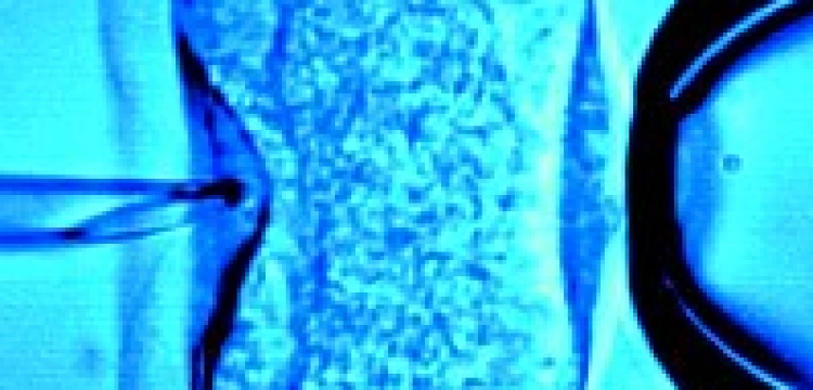 Poczęte, by je zabić