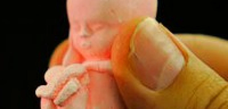 Tea Party już nie chce bronić życia 