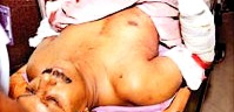 Profesor obraził Mahometa. Ucięto mu rękę 