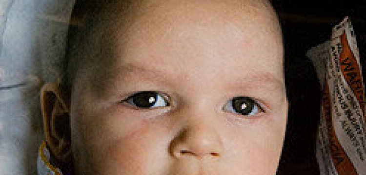 Baby Joseph po tracheotomii