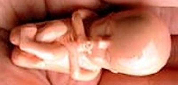 Katolicka diecezja jednak nie potępia akcji niemieckich obrońców życia