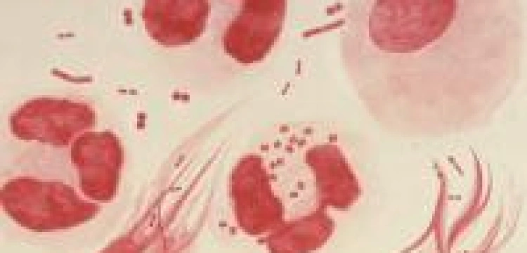 Nadchodzi era rzeżączki?