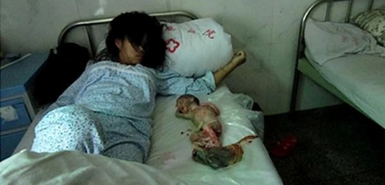 Szokujące zdjęcie - kobieta zmuszona do aborcji w 7. miesiącu