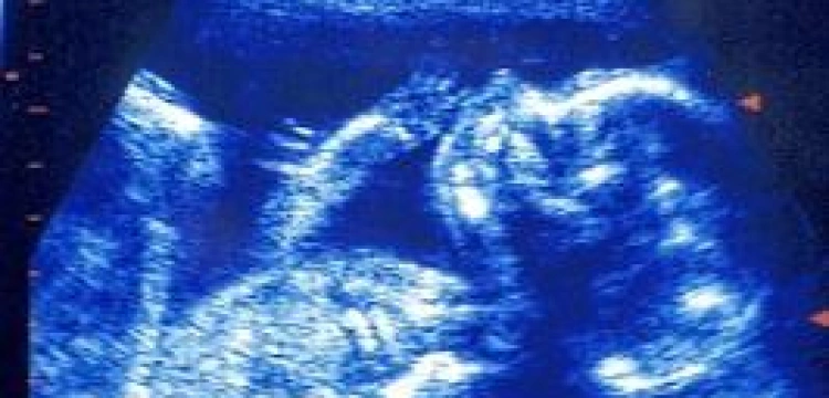 Zobacz narodziny dziecka ... od środka