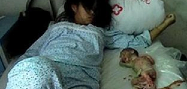 Chiński urzędnik stracił pracę po zmuszeniu kobiety do aborcji w 7. miesiącu ciąży!