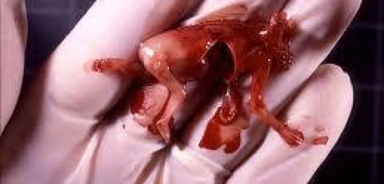 Znaleziono 248 ludzkich płodów... w lesie!