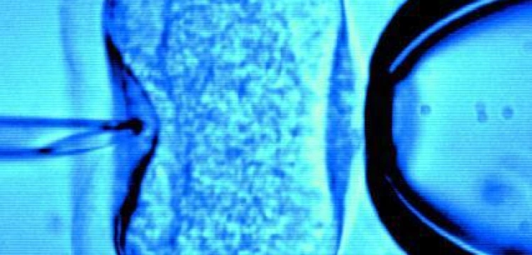 Zmodyfikowane genetycznie dzieci, mające 3 biologicznych rodziców, są już nastolatkami?