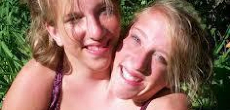 Reality show o siostrach syjamskich